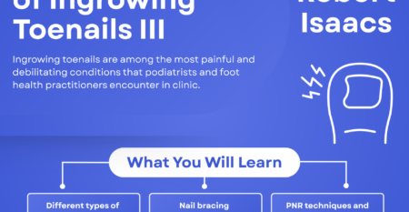 The Management of Ingrown Toenails